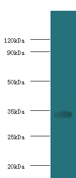 Cd74 Polyclonal  Antibody