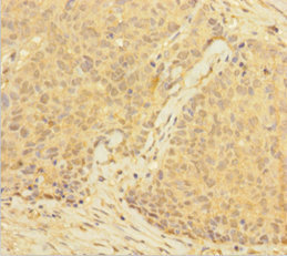 MSLN Polyclonal Antibody
