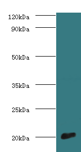 COX4I1 Polyclonal Antibody