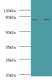 CFB Polyclonal Antibody