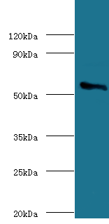 CYP11A1 Polyclonal Antibody