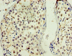 TMX3 Polyclonal Antibody