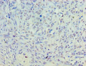 PLD5 Polyclonal Antibody
