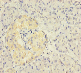 ZNF114 Polyclonal Antibody