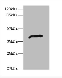 Western blot<br />All lanes: ADH7 Polyclonal Antibody at 2ug/ml+ Mouse liver tissue<br />Goat polyclonal to rabbit at 1/10000 dilution<br />Predicted band size: 42, 43 kDa<br />Observed band size: 41 kDa<br />