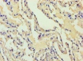 Immunohistochemistry of paraffin-embedded human lung tissue at dilution 1:100
