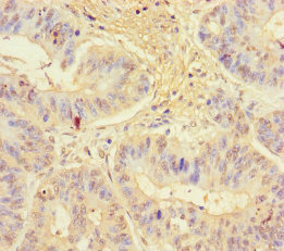 KLRG1 Polyclonal Antibody