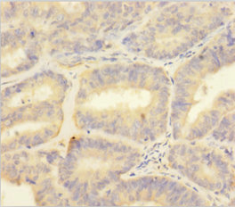 S100A1 Polyclonal Antibody