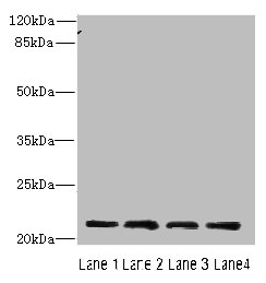 CRADD Polyclonal Antibody