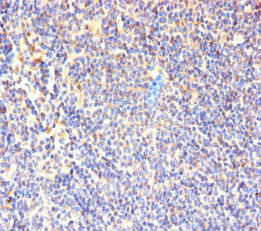 CD7 Polyclonal Antibody