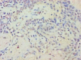 EYA2 Polyclonal Antibody (20 µl)