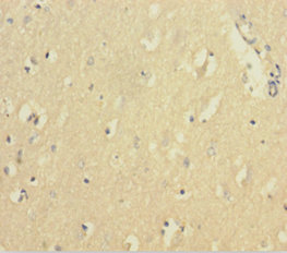 FTL Polyclonal Antibody