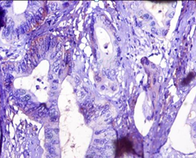 TTR Polyclonal Antibody
