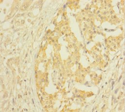CLTB Polyclonal Antibody