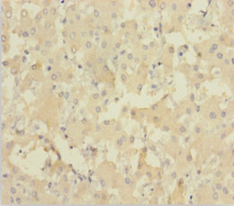 Immunohistochemistry of paraffin-embedded human liver tissue using NEIL1 Polyclonal Antibody at dilution 1:100