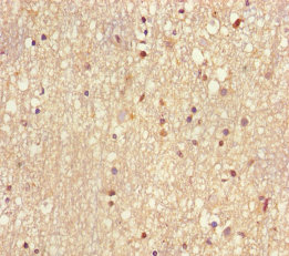 UBE2V2 Polyclonal Antibody