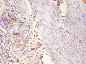 ESR1 Polyclonal Antibody