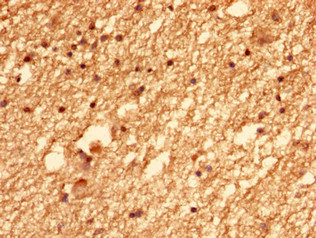 CEP126 Polyclonal Antibody