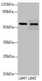 GLP1R Polyclonal Antibody (100 µl)