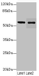 GLP1R Polyclonal Antibody