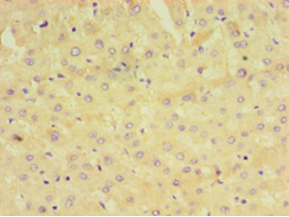 Immunohistochemistry of paraffin-embedded human liver tissue using GRA1 Polyclonal Antibody at dilution 1:100