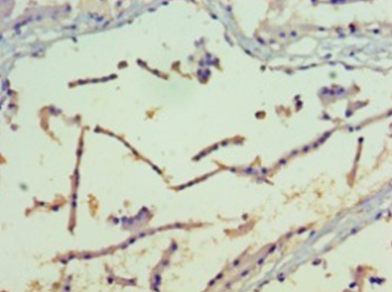 PAK4 Polyclonal Antibody