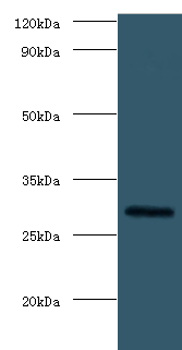 Fgf23 Polyclonal Antibody