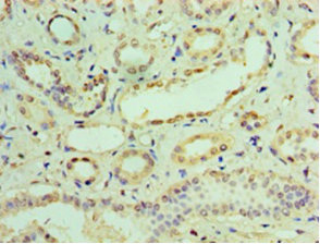Immunohistochemistry of paraffin-embedded human kidney using IFIT3 Polyclonal Antibody at dilution 1:100