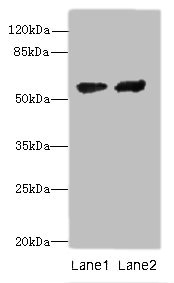 CYP17A1 Polyclonal Antibody