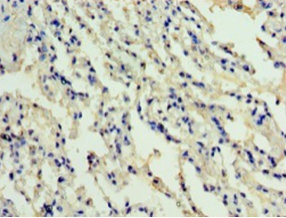 Immunohistochemistry of paraffin-embedded human lung tissue at dilution 1:100