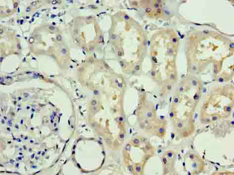 Immunohistochemistry of paraffin-embedded human kidney tissue at dilution of 1:100