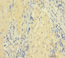 FASLG Polyclonal Antibody