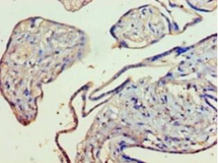 KMO Polyclonal Antibody