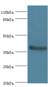 CA12 Polyclonal Antibody