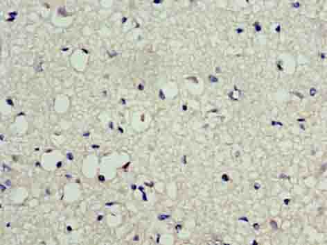 LSM10 Polyclonal Antibody