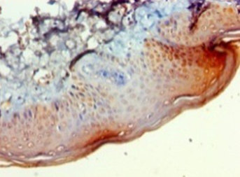 Immunohistochemistry of paraffin-embedded human skin tissue at dilution 1:100