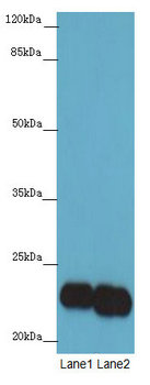 PTPMT1 Polyclonal Antibody