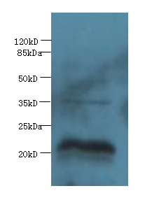EEF1E1 Polyclonal Antibody
