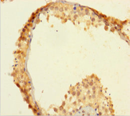 ZSCAN20 Polyclonal Antibody