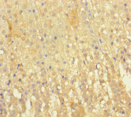 EML2 Polyclonal Antibody