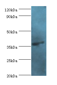 AGA Polyclonal Antibody