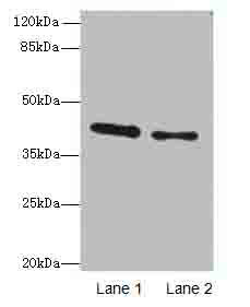 AGA Polyclonal Antibody (100 µl)