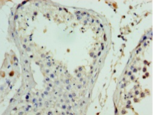 FANK1 Polyclonal Antibody