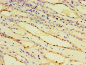 IDUA Polyclonal Antibody