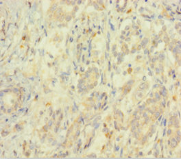 EIF5 Polyclonal Antibody