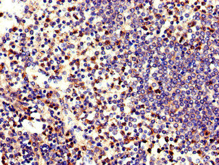 ELANE Polyclonal Antibody