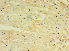 TRIM11 Polyclonal Antibody