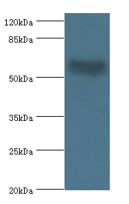 AMH Polyclonal Antibody