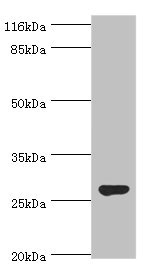 Western blot<br />All lanes: IZUMO4 Polyclonal Antibody at 2ug/ml+rat gonad tissue<br />Secondary<br />Goat polyclonal to rabbit at 1/10000 dilution<br />Predicted band size: 27, 25, 18, 19 kDa<br />Observed band size: 27 kDa<br />