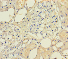 SMARCB1 Polyclonal Antibody